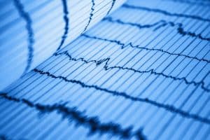 Comment interpréter un électrocardiogramme : guide pratique