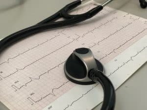 Comment interpréter un électrocardiogramme : guide pratique